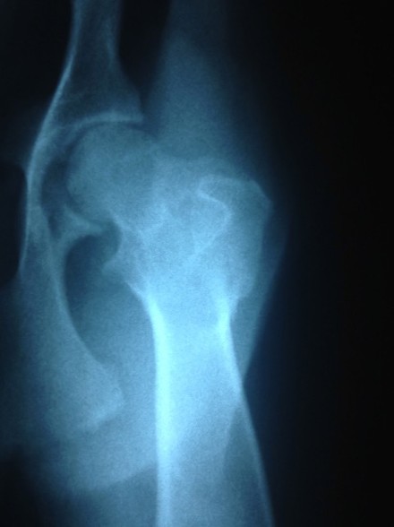 bone cancer in dogs