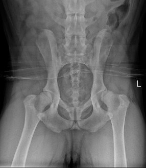 9 month female hip dysplasia