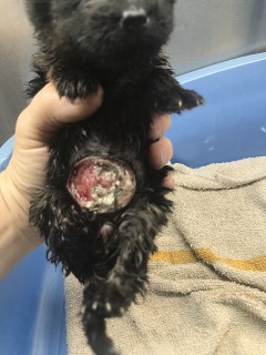 Umbilical hernia wound