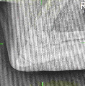 5 month rottweiler elbow xray