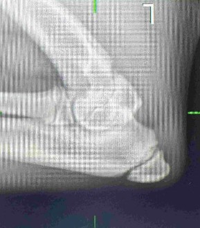 Rottweiler puppy elbow xray 5 months