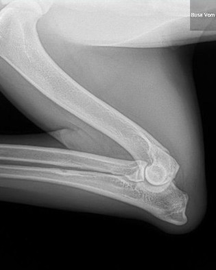 usa right lateral ED xrays
